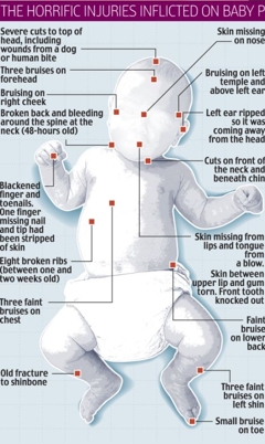 Attached picture baby p injuries.jpg